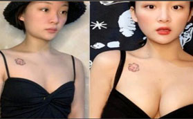 洛陽華美醫(yī)療美容醫(yī)院做假體隆胸怎么樣？看我就知道啦！