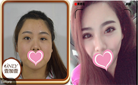 通過(guò)丁洪如眼綜合真人案例看北京壹加壹確實(shí)正規(guī)靠譜