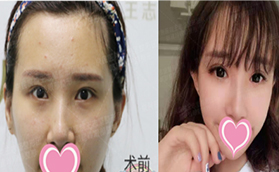 通過(guò)郭建玲眼綜合真人案例看北京京民是否正規(guī)靠譜？