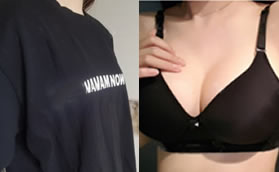 今天說說我在衡陽曹家做德國寶儷水滴假體隆胸1年后的手感!