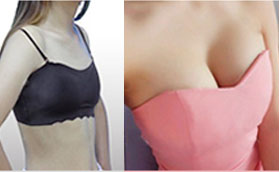 安徽維多利亞隆胸手術(shù)