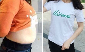 濟南藝星大腿/腰腹多位層環(huán)吸