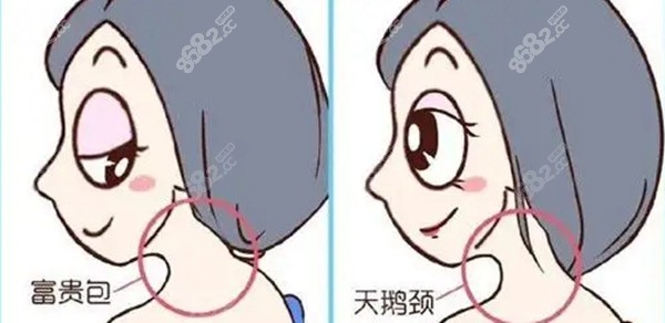 黃學(xué)峰一針微創(chuàng)富貴包真的好 黃學(xué)峰一針微創(chuàng)富貴包真的好